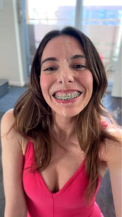 Cute MILF with braces'