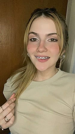Cute Babe with Braces on in Fun Mode'